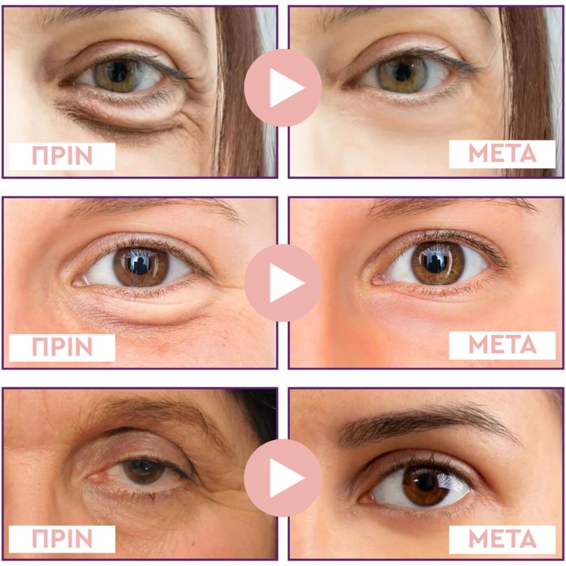 Microderm® MicroGlow Patches