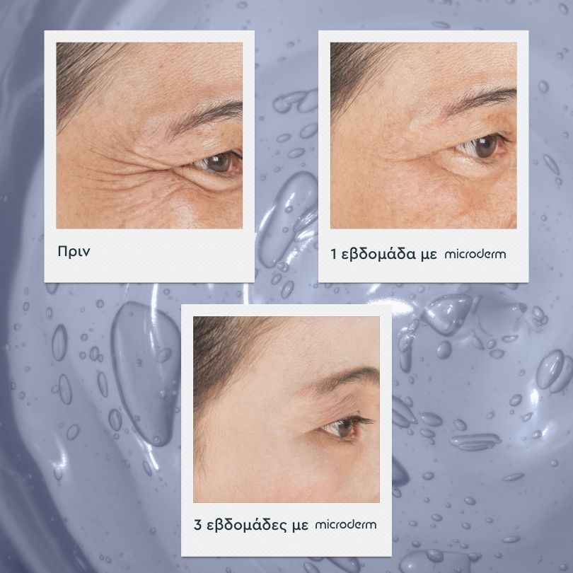 Microderm® MicroGlow Patches